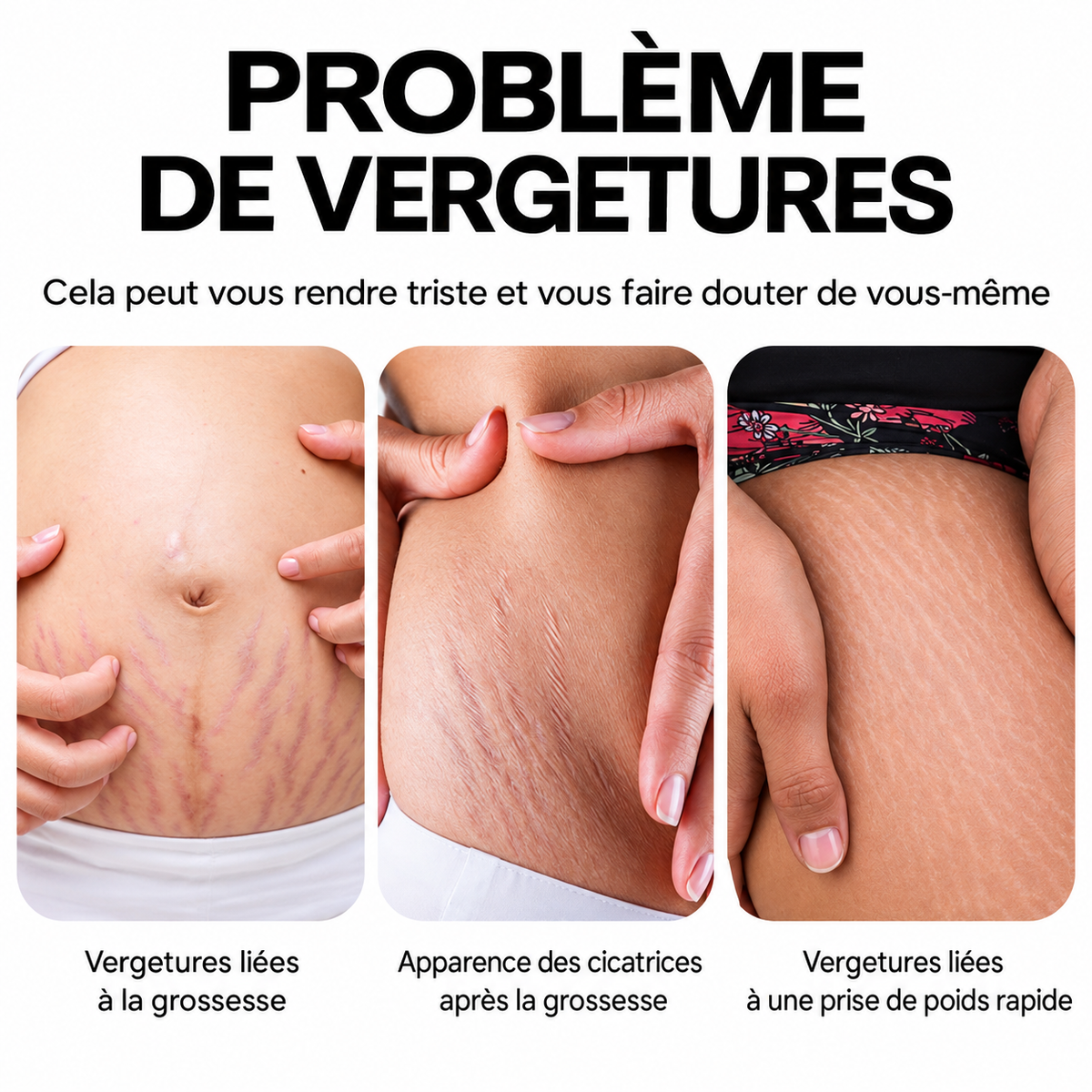CRÈME RÉPARATRICE ANTI-VERGETURES