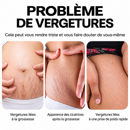 CRÈME RÉPARATRICE ANTI-VERGETURES
