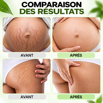 CRÈME RÉPARATRICE ANTI-VERGETURES